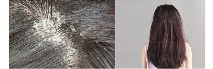 ���ϼ���-�Ř�(sh��)ɽ����ϴ�l(f��)��