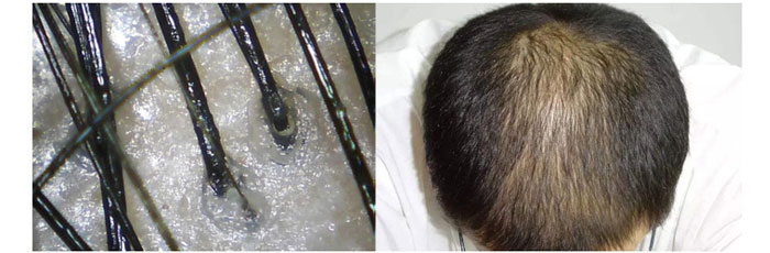 ���ϼ���-�Ř�(sh��)ɽ����ϴ�l(f��)��