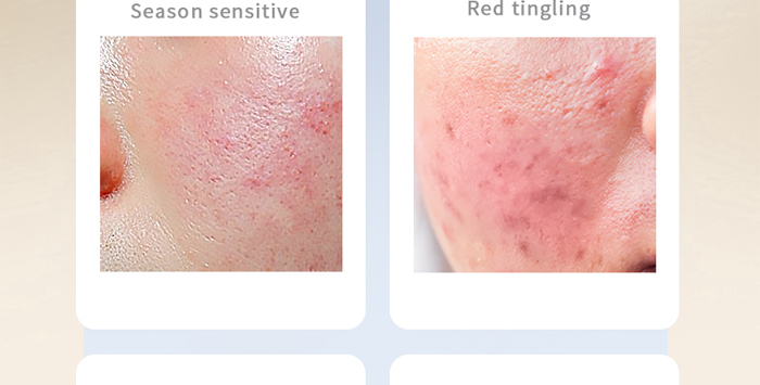 �ŭZ���澏���o��